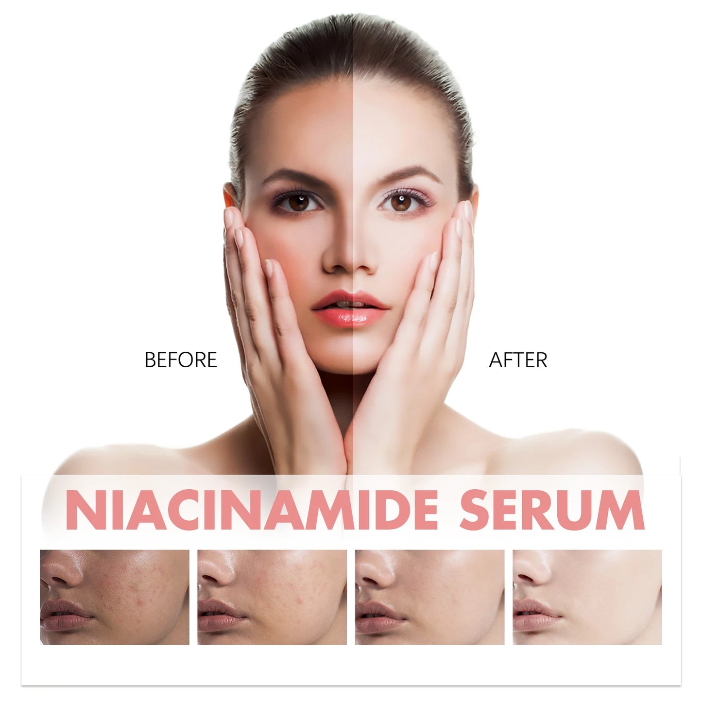 Niacinamide Facial Serum for Brightening & Dark Spot Care