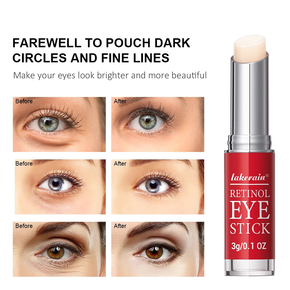 Retinol Eye Cream Stick for Smoother, Brighter-Looking Eyes