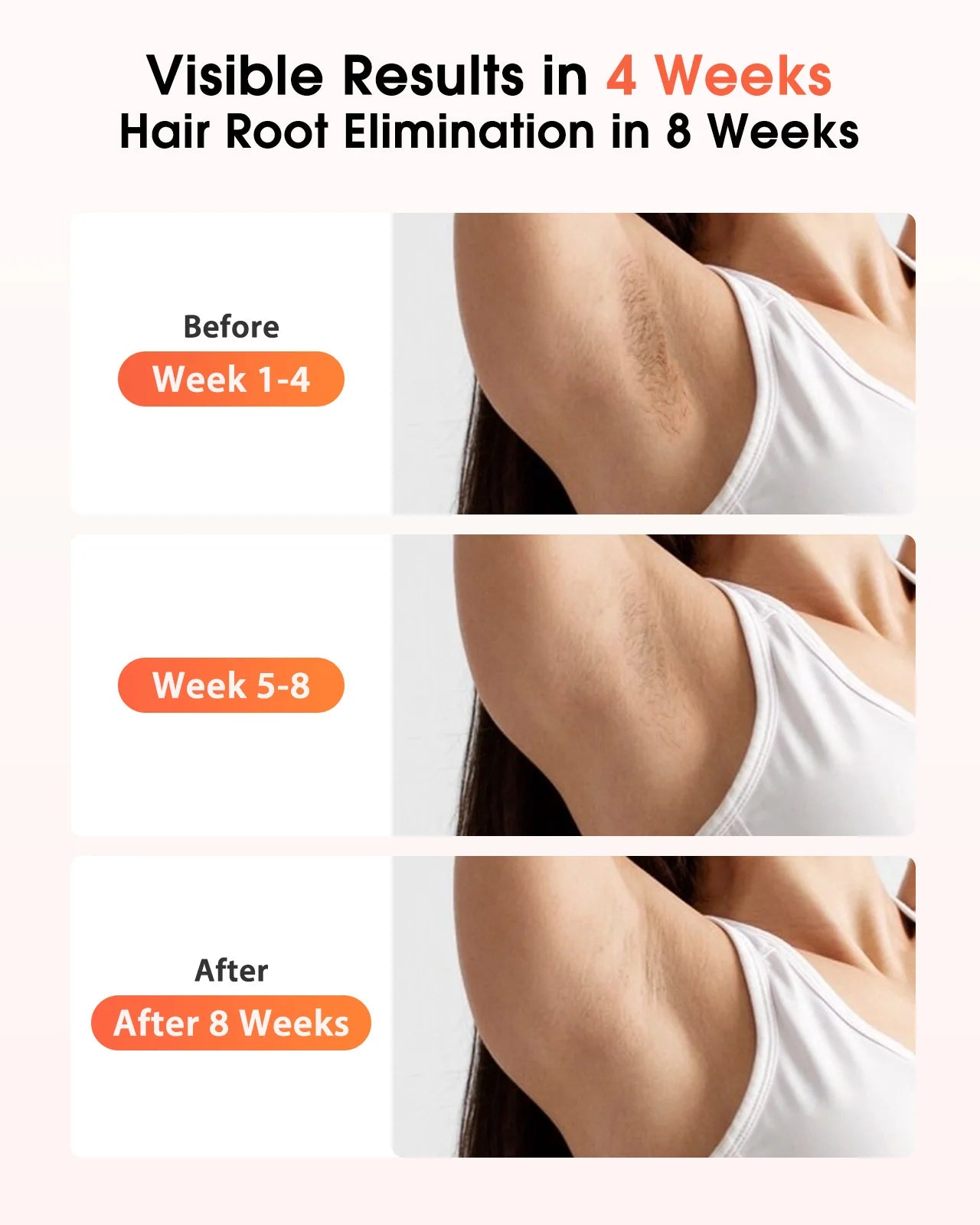 IPL Hair Removal Device 17J 999900 Light Pulses