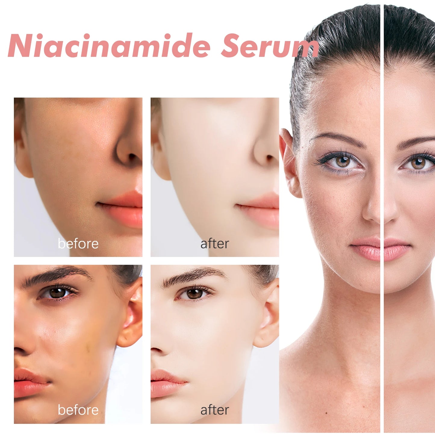 Niacinamide Facial Serum for Brightening & Dark Spot Care