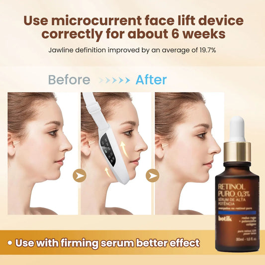 Electric V-Face Toning Device | Microcurrent Facial Sculpting Tool