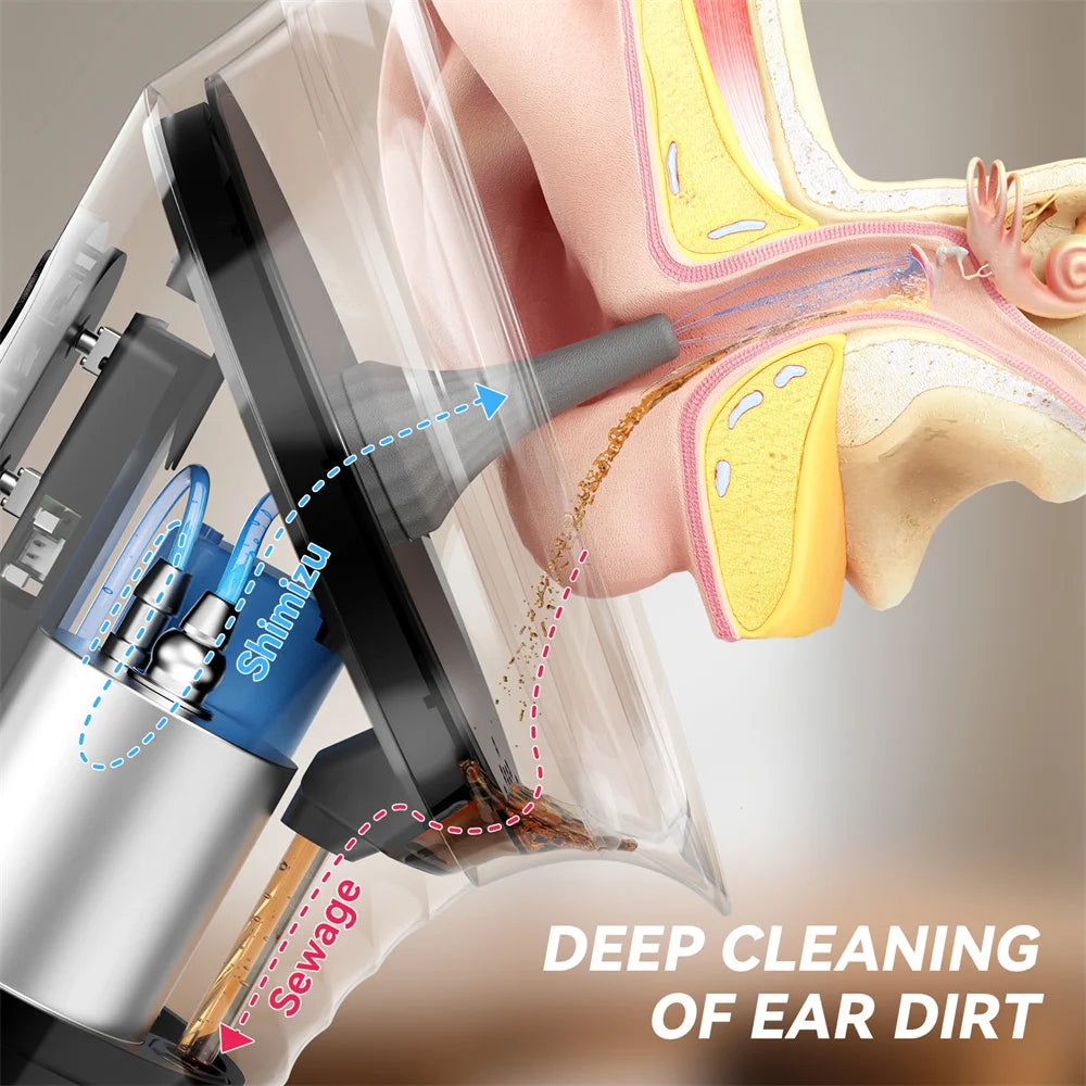 Electric Ear Irrigation Cleaning Kit
